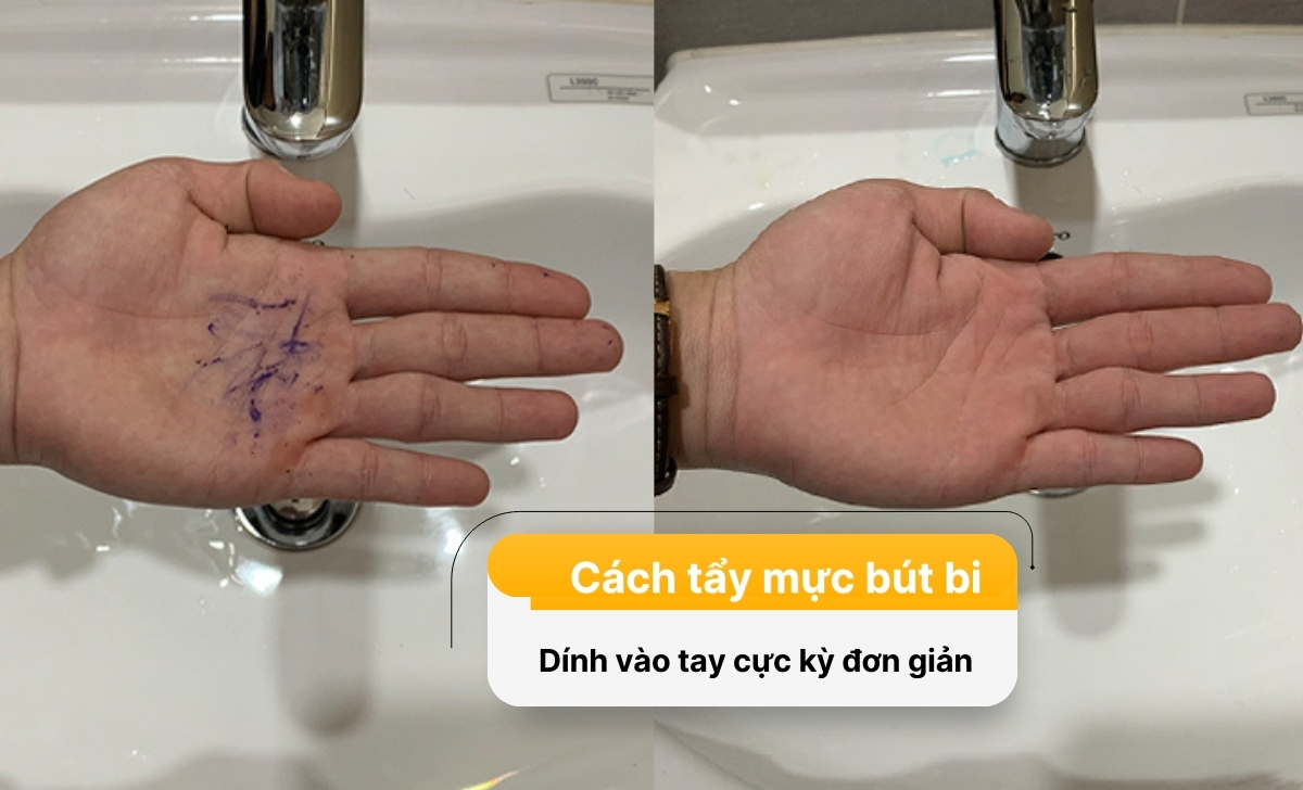 Hướng dẫn cách tẩy mực bút máy dính vào tay trong tích tắc